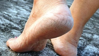 Photo of ये घरेलू उपाय दिलाएंगे फटी एड़ियों से छुटकारा, जल्द दूर हो जाएगी समस्या