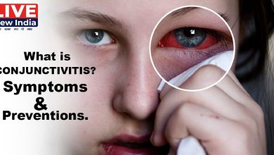 Photo of Conjunctivitis:बारिश के मौसम में कंजंक्टिवाइटिस के मामले बढ़े