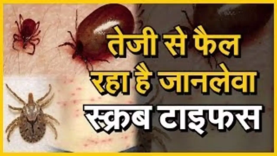 Photo of Health News: रहस्यमयी बुखार ‘स्क्रब टायफ़स’ की चपेट में उत्तर प्रदेश