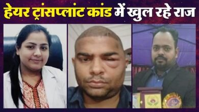 Photo of कानपुर हेयर ट्रांसप्लांट मौत मामले में नया खुलासा; दांतों की डॉक्टर ने की थी सर्जरी?