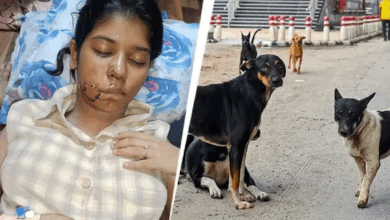 Photo of कानपुर में आवारा कुत्तों ने किया छात्रा पर हमला, चेहरे पर लगे 17 टांके…