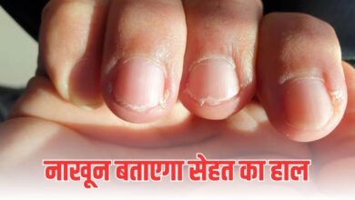 Photo of नाखून सिर्फ सुंदरता नहीं, स्वास्थ्य का भी आईना हैं… देता है ये संकेत