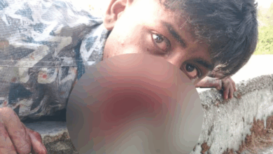 Photo of Viral News: रील के लिए मुंह में फोड़े सुतली बम, जबड़े के चीथड़े उड़ गए
