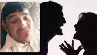 Photo of UP News: EX गर्लफ्रेंड को जबरन KISS करने की कोशिश, लड़की ने शख्स की काटी जीभ…