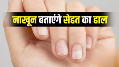 Photo of नाखूनों में बदलाव हो सकता है गंभीर बीमारी के संकेत, जानें वजह और सावधानियां…