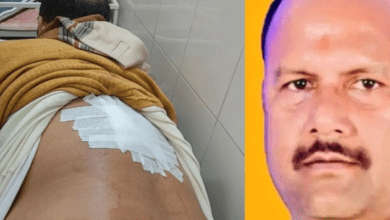 Photo of UP News: गोरखपुर में BJP नेता को मारी गोली, चार बदमाशों ने की फायरिंग