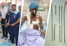 Photo of KGMU के डॉक्टरों का चमत्कार, मजदूर के शरीर के आर-पार हुए लोहे के सरिये; ऐसे बचाई जान