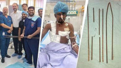 Photo of KGMU के डॉक्टरों का चमत्कार, मजदूर के शरीर के आर-पार हुए लोहे के सरिये; ऐसे बचाई जान